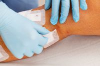 тромбофлебит - 18225 награди