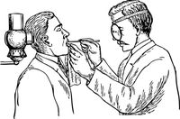 възпаление на венците - 69501 варианти