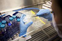 съхранение на стволови клетки цена - 15786 типа | Bioregeneration съхранение на стволови клетки цена - 60953 типа
