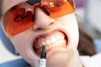 Зъбни импланти - 55762 новини