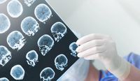 физиотерапия по здравна каса - 50092 предложения | Rehab-bg физиотерапия по здравна каса - 36360 предложения