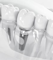 мезотерапия Варна - 13334 снимки