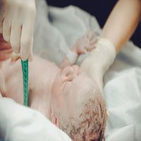 Стволови клетки от пъпна връв - 5258 отстъпки Стволови клетки от пъпна връв - 64313 отстъпки